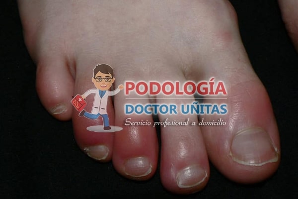 mal olor, sudor en exceso 