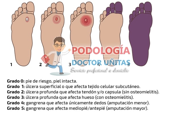 cuida tus pes, son tan importantes para movelizarse
